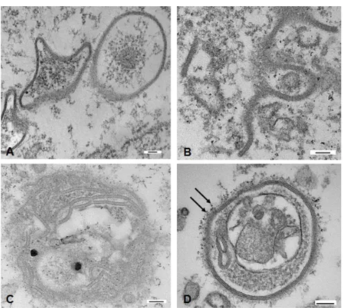 Figure 3.  TEM of cytoplasmic gap junction structures. (A) Two star shaped annular gap junctions seen next to a typical annular gap junction vesicle