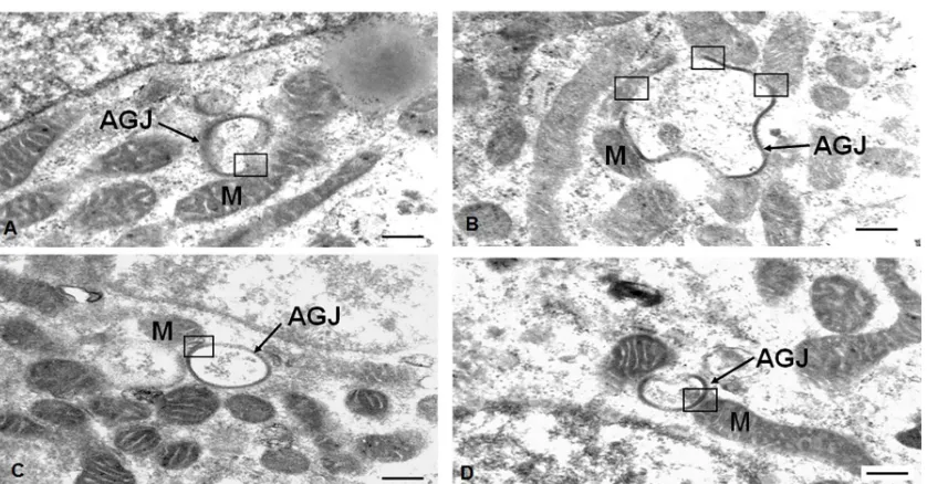 Figure 6. Transmission electron microscopy of mitochondria closely associated with annular gap junctions