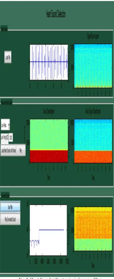 Fig. 9. Heart Sound without noise in low pass filter  