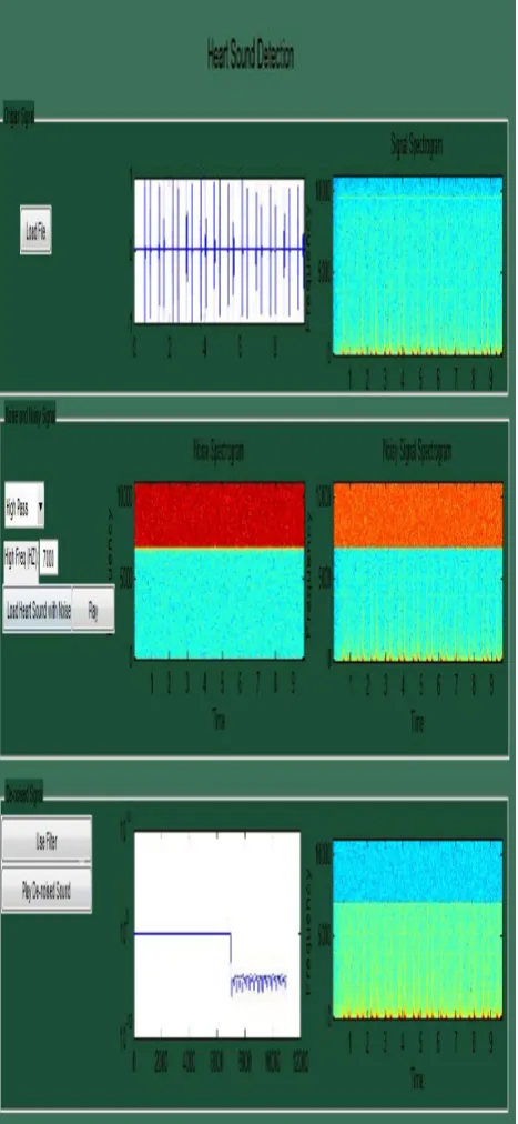 Fig. 11. Heart Sound without noise with high pass filter 