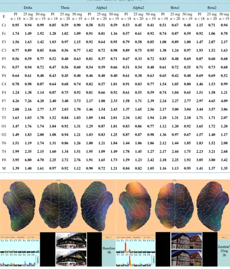 Figure 2. Representative scene of 364 ms duration during baseline recording (left side) and in the presence of 25.0 mg Zembrin® 2 h after intake (right side)