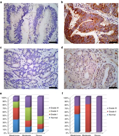 Figure 5 | Analysis of human colon and prostate cancer tissues for Y160 phosphorylation