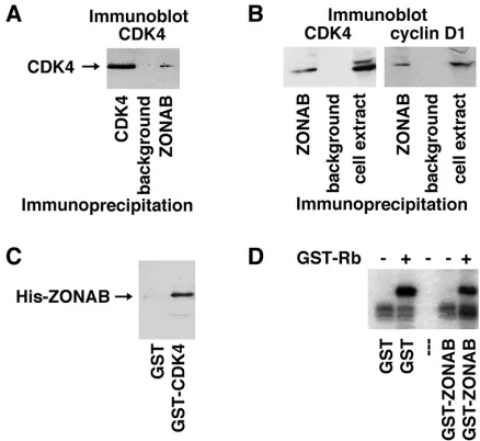 Figure 6.Interaction of ZONAB with CDK4. MDCK cells were extracted under stringent conditions (A) or in PBS-Triton X-100 (B), and cell extracts were subjected to immunoprecipitation with the indicated antibodies
