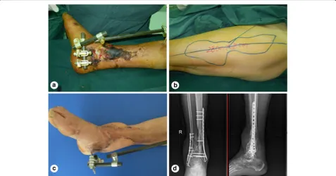 Fig. 4 Incidence of the chronic osteomyelitis (a). Internal fixator is removed (b)