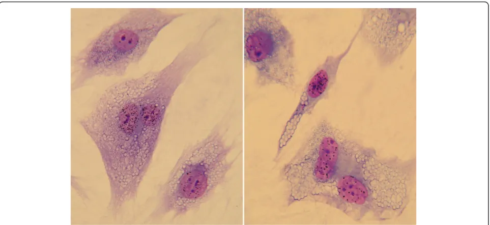 Figure 2 Complementation testunscheduled DNA synthesis (UDS) in heterodikaryons obtained following fusion of primary dermal fibroblasts of the patient under study withcells representative of each of the various XP groups