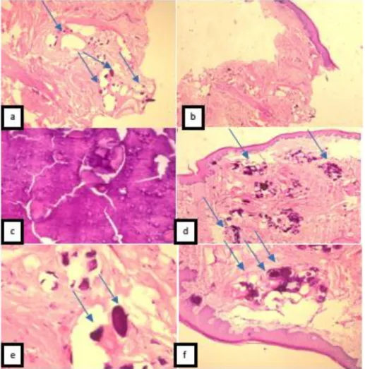 Figure  2  (a,bx4)  Calcified  intradermal  nodule  lacking  an  epithelial  lining.  (c,dx10)  Original 