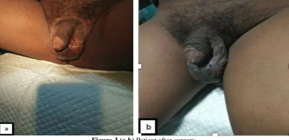 Figure 3 (a,b) Patient after surgery 