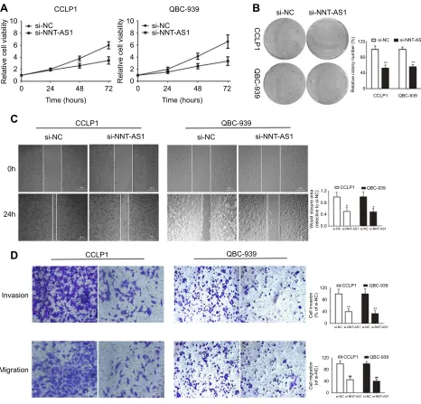Figure 2 Knockdown of NNT-AS1 inhibited cell proliferation, migration and invasion in vitro.Notes: (A) CCK-8 assays were used to determine the viability of si-NNT-AS1-transfected cholangiocarcinoma cells