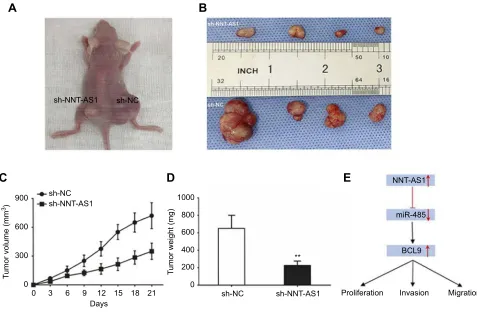 Figure 5 NNT-AS1 knockdown suppressed tumor growth in vivo.injected with CCLP1 cells transfected with sh-NC and sh-NNT-AS1 was analyzed