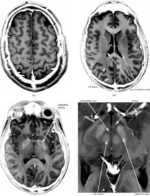 Figure 2. Same images as in Figure 1, presented with an inverted grey scale (with Figure 2d showing an expanded region fromFigure 1d)