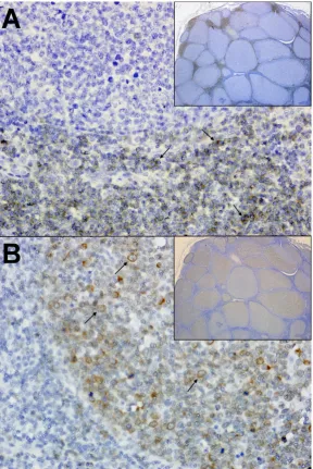Figure 1. Immunohistochemistry from a FIV-infected cat with primary B cell lymphoma.  (A) Mesenteric lymph Node; 40x and 4x (inset)