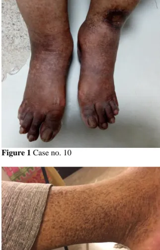 Figure 1 Case no. 10 