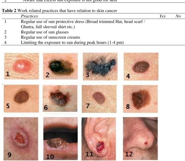 Table 1 Parameters in questionnaire to study awareness regarding skin cancer 