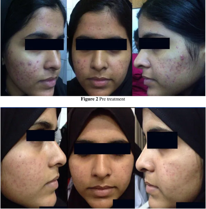 Figure 2 Pre treatment 