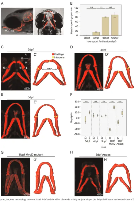 Fig. 2. Changes to jaw joint morphology between 3 and 5 dpf and the effect of muscle activity on joint shape