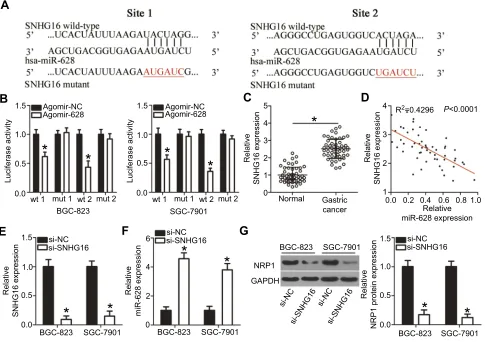 Figure 5 SNHG16 functions as a ceRNA and regulates NRP1 expression in gastric cancer by competitively binding miR-628