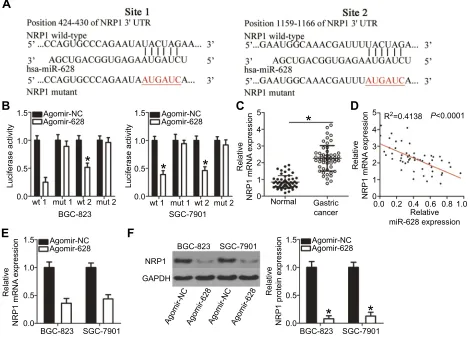 Figure 3 Validation of NRP1 mRNA as a direct target of miR-628 in gastric cancer. (gastric cancer tissue samples and matched adjacent normal tissue samples