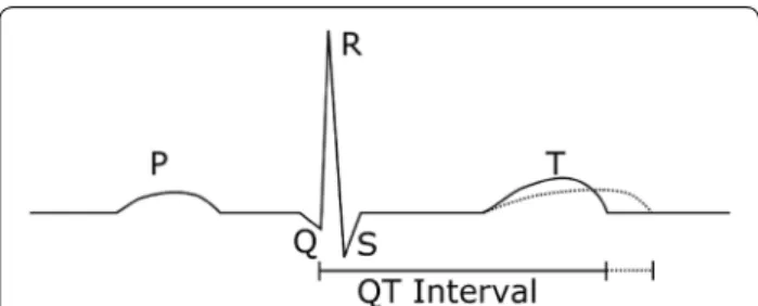 Fig. 1  Idealised illustration of a QT interval prolongation as measured 