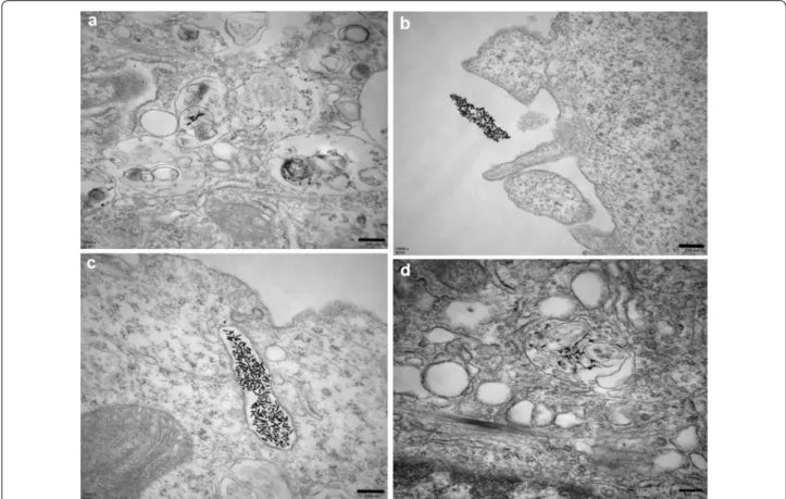 Fig. 4  TEM images show the localization of PTX/CUR/Au NRs or PTX/CUR/Au NRs@cRGD inside an A549 cell