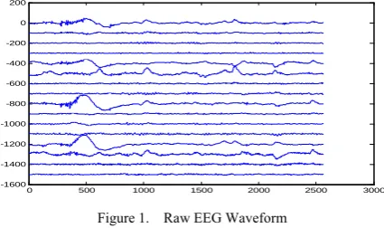 Figure 1.    Raw EEG Waveform 
