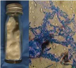Figure  2  A  microscopic  feature  of  the  lactophenol 