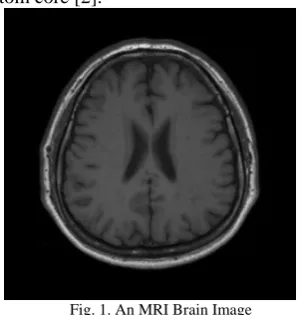 Fig. 2. A histogram of an image 