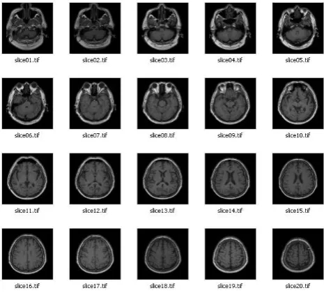 Fig. 3. Extracted and converted MRI Image files 