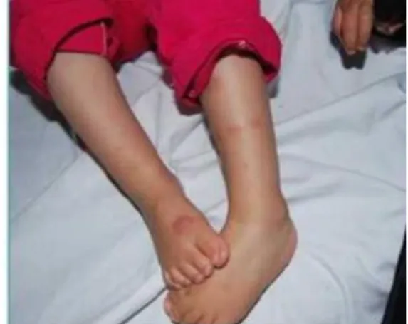 Figure  1  Multiple  reddish-brown  macules  and  patches  on the back of the body. 