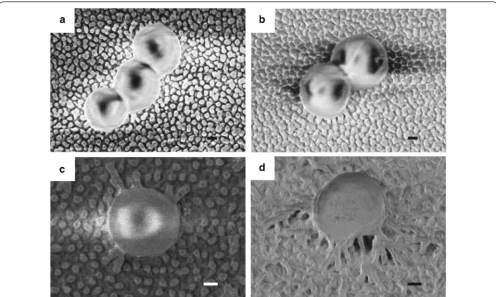 Fig. 5  SEM images of S. aureus cells on nanostructured Ormostamp surfaces S(b) and S(c): a, b are top and tilted views on S(b); c, d are top and 