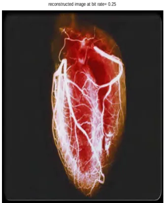 Fig. 2(d) Reconstructed Image at bit rate =0.25   