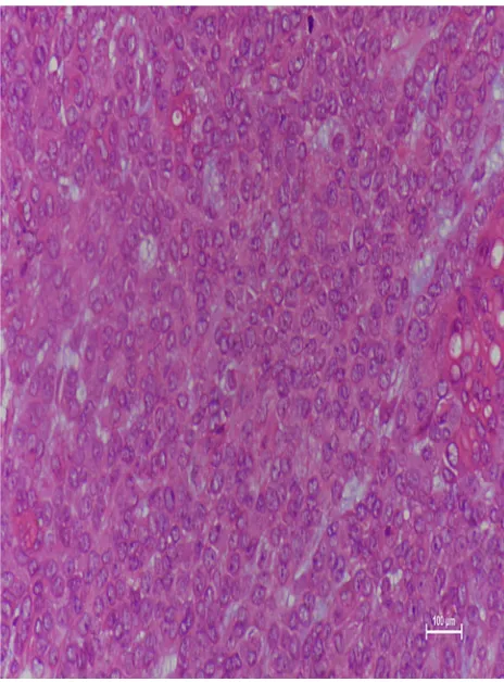 Figure 6 Distribution of primary sites among patients with sinonasal/nasopharyn-geal PA and CXPA.