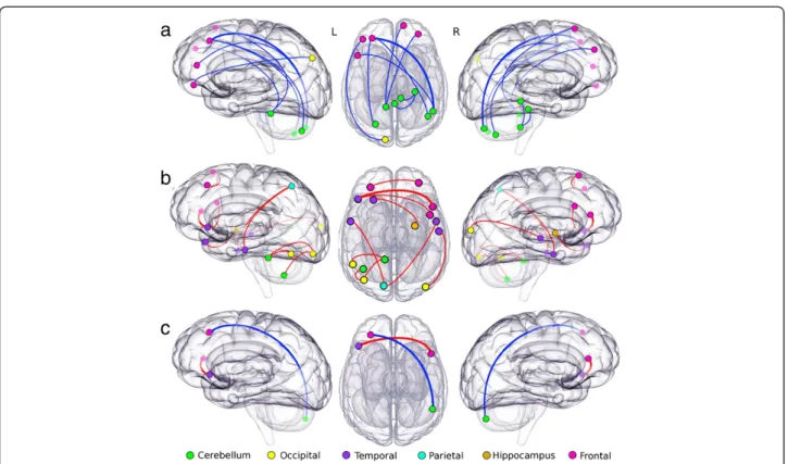 Figure 1 Highest differences between patients with SCA7 and healthy controls. Nodes represent the AAL regions involved in each of 19 abnormal functional connections