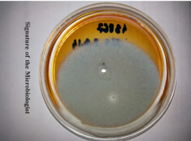 Figure  1  Reverse  view  of  colony  morphology  of  Trichophyton mentagrophyte 14 days after incubation  in Saboraud’s dextrose agar