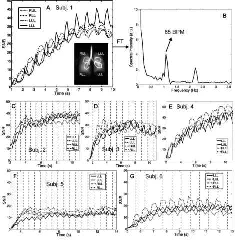 381 Figure 2: 