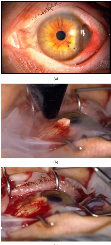 Figure 4(a)metastasize to regional lymph nodes and other organs, 