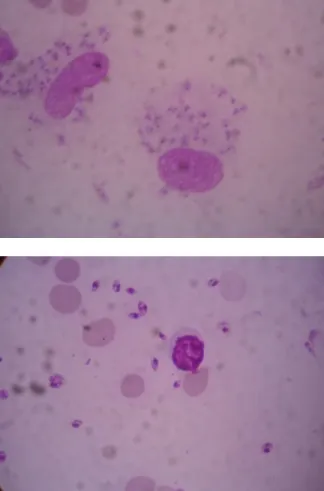 Table 2 Sensitivity and specificity of skin-split smear as compared to histopathology, the gold standard (n=50)