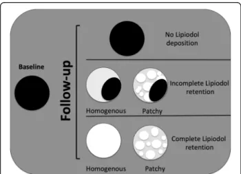 Fig. 2 Schematic representation of lipiodol retention patterns on precontrast CT after cTACE