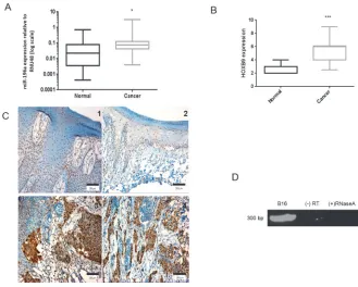 Fig 3. miR-196a and HOXB9 are up-regulated in HNSCC tissue samples. 3A-C. Expression of miR-196a(3A) and HOXB9 in tissues (3B, 3C) measured by qPCR of LCM tissues and immunohistochemistry,respectively