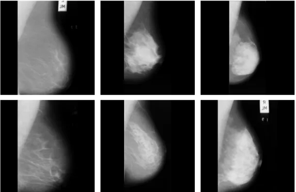 Figure 2.5: Examples of different tissue types available in the Mini-MIAS database 