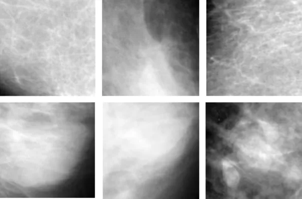 Figure 2.6: Sample mass ROIs first row and normal ROIs second row 