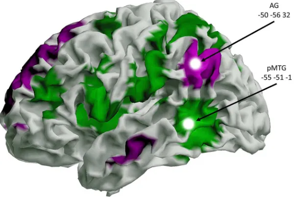 Figure 1.The two TMS sites and their differing resting-state connectivity. The MNI coordinates shown are the average stimu-normality (paired-samplesprocessedusingDPARFS(version2.3)toolbox(lationsitesusedinthisstudy.Thetargetstimulationsitesweretakenfromtwo