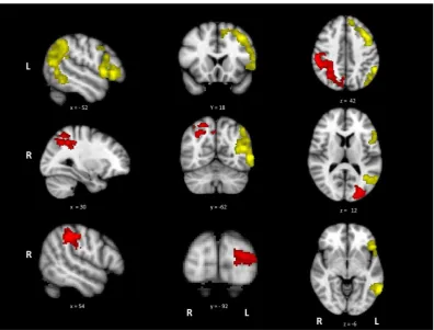 Fig. 2. Activation maps for action > visual (yellow) and visual > action (red), presented on the MNI-152 standard brain with cluster correction applied (voxel inclusionthreshold z = 2.3, cluster signiﬁcance threshold p < .05)