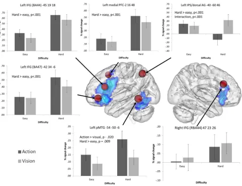 Fig. 4. 8 mm ROI spheres placed around peaks from a ALE meta-analysis examining executive–semantic demands (compared with the independent whole-brain contrast for hard > easy trials (in blue), they are displayed together on a glass brain using DV3D, with d