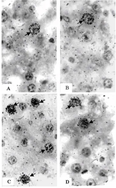 Fig. 2. Sections of rat livers showing the distribution of labelled cells (arrows) and the  density of grains over the labelled nuclei