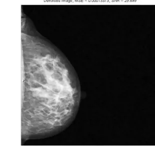 Figure 7: Sample results of the denoised mammographic images from the DDSM database