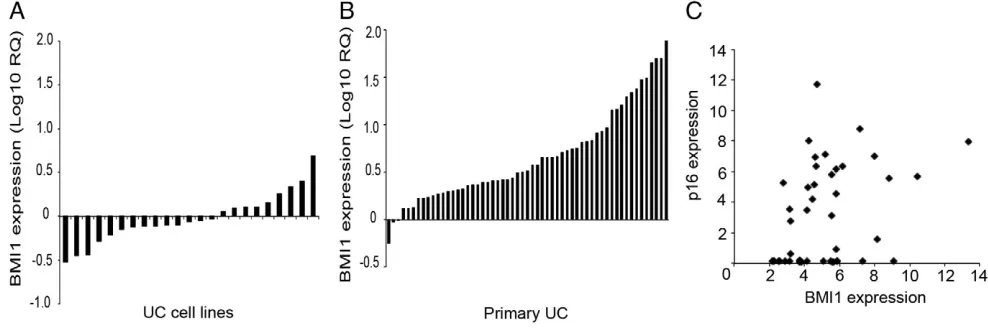 Figure 1. (A) Overexpression of BMI1 in UC tumor cell line panel as detected by QRTPCR