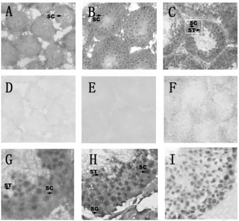 Fig. 4. The cellular location of srsf mRNA in the testes as detected via in situ  hybridization