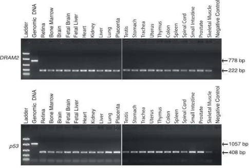 Figure S4. DRAM2 mRNA is ubiquitously expressed in all human tissues analysed. Human adult and 
