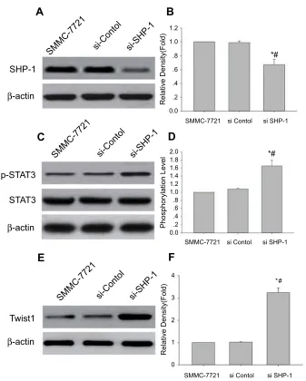 Figure 5 Knockdown of SHP-1 induced the p-STAT3 and Twist1 expression. Western blot analysis has performed the levels of SHP-1, p-STAT3 (Tyr705) and Twist1in SMMC-7721 cells transfected with SHP-1 siRNA; β-actin was used as an internal control