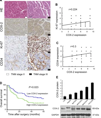 Figure 2 Association of COX-2 expression between clinicopathological features and 5-year overall survival in human HCC, and expression of COX-2 in the normal humanliver cell and HCC cell lines